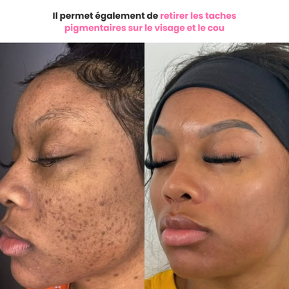 Duo Correcteur Éclat